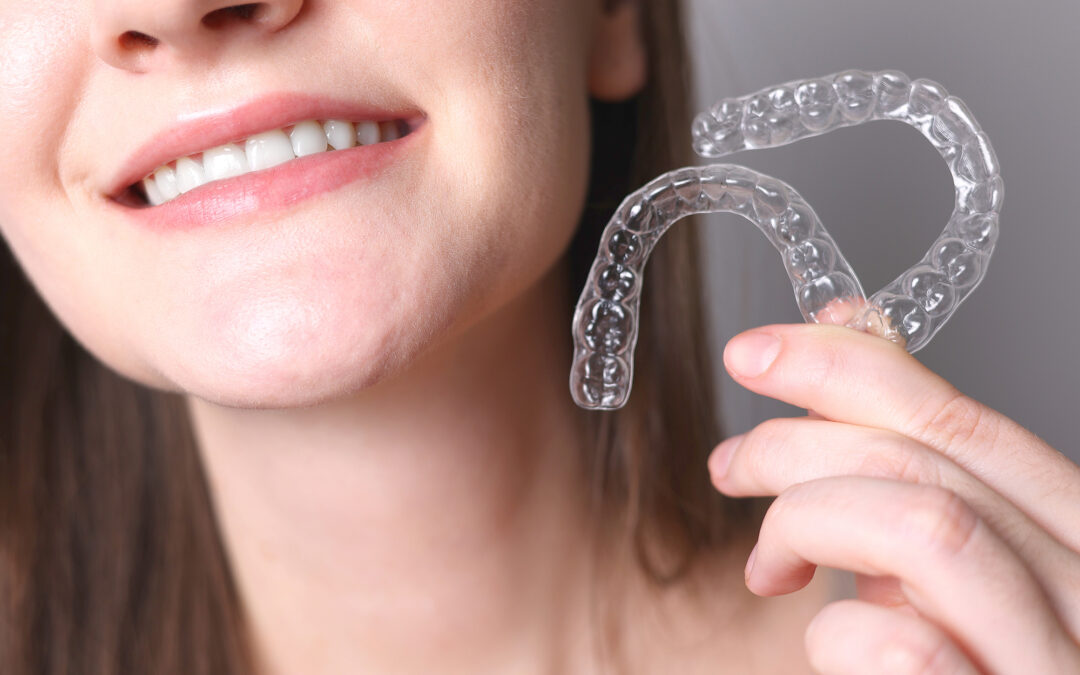 Clear Aligners